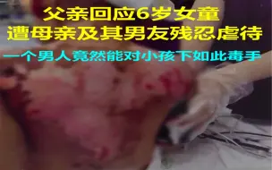 下载视频: 父亲回应6岁女童遭母亲及其男友残忍虐待：一个男人竟然能对小孩下如此毒手