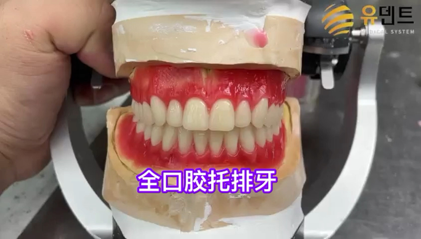 全口胶托排牙by张日焕#胶托#牙匠之家
