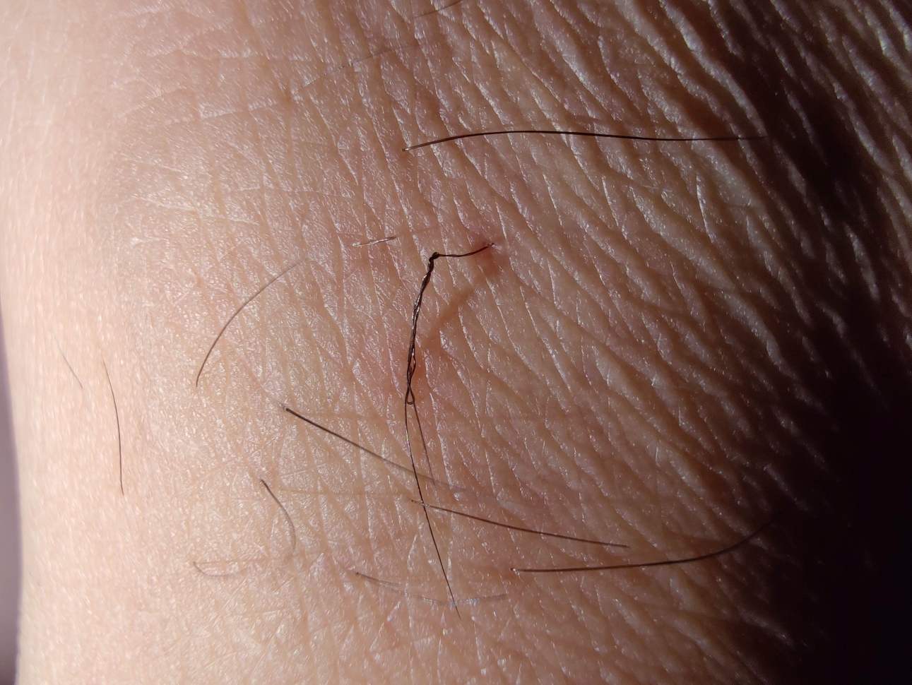 运气不好的时候.腿毛都打结