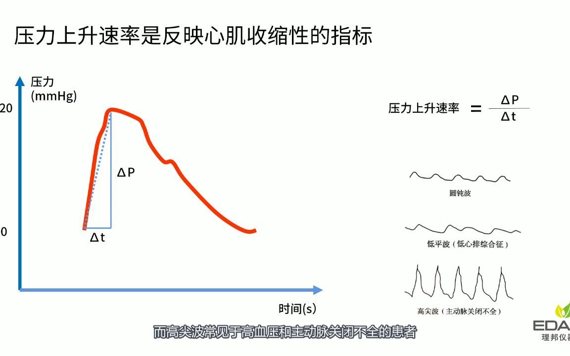 有创动脉血压的波形要怎么看?_哔哩哔哩_bilibili
