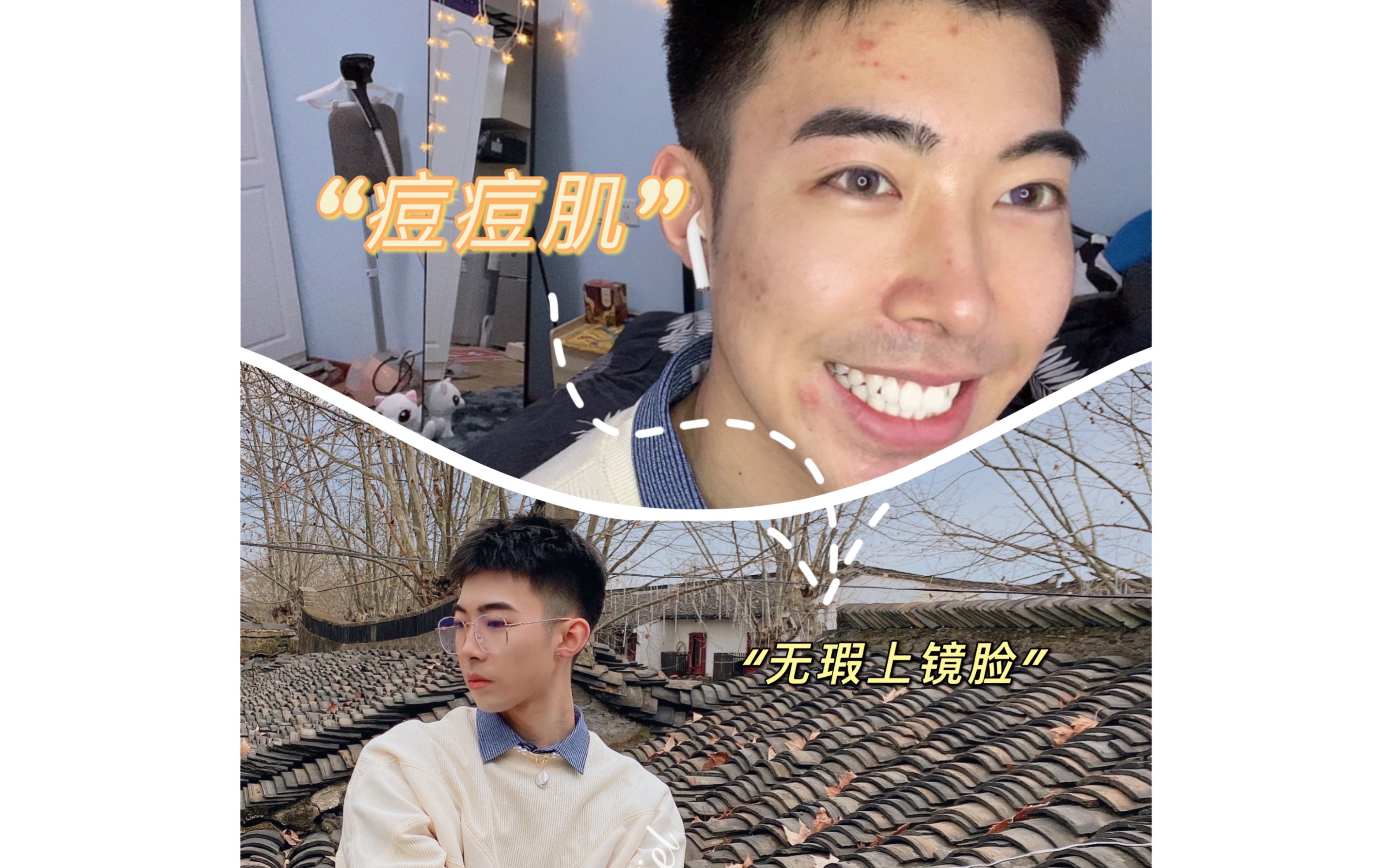 混干痘痘肌男生 如何打造日常,上镜妆容
