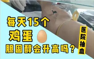 Скачать видео: 小伙每天15个鸡蛋，坚持一周，医院抽血查胆固醇都懵了！！