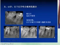 Descargar video: 读片基本功——如何解读口腔CBCT