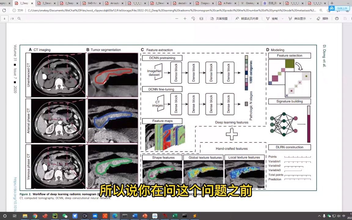 影像组学如何实现胃癌转移的淋巴结数量预测哔哩哔哩bilibili