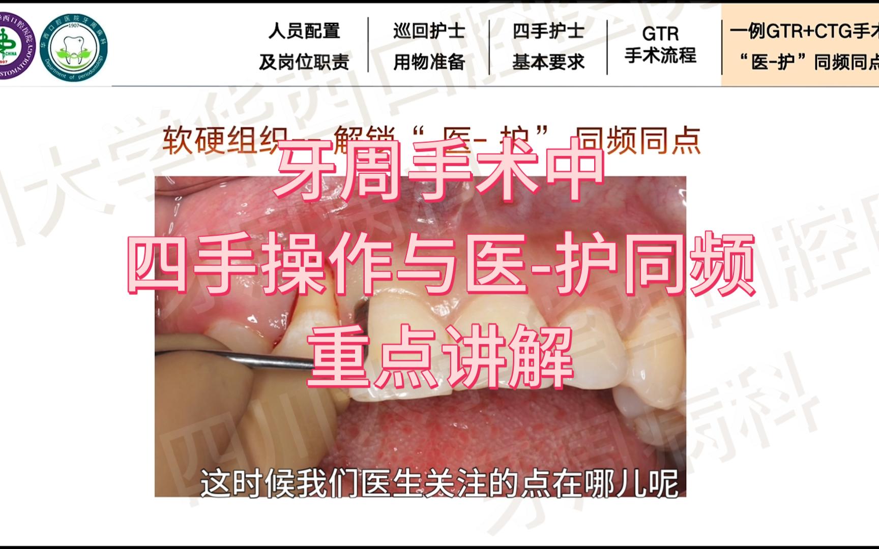 7.牙周手术中四手操作与医护同频重点哔哩哔哩bilibili