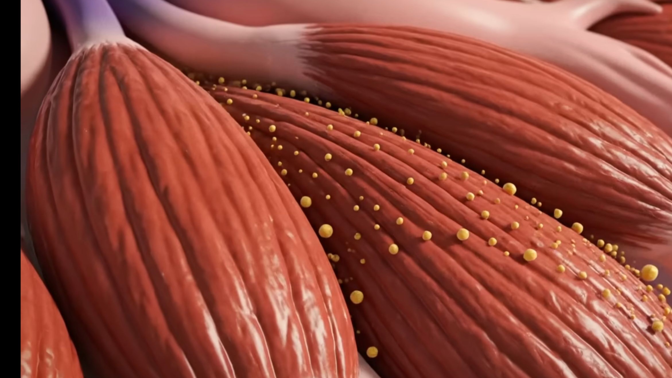 燃烧大腿内侧脂肪和消除橘皮组织的最佳方法!| Dr. Eric Berg DC-科学健康治愈george-科学健康治愈george-哔哩哔哩视频