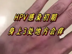 身上3处地方发痒，大概率是感染了hpv