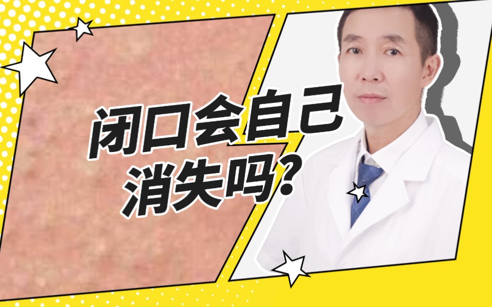 闭口会自己消失吗?哔哩哔哩bilibili