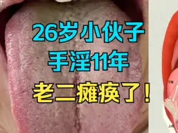 Descargar video: 26岁小伙子，手淫11年，老二瘫痪了，神仙难救！！