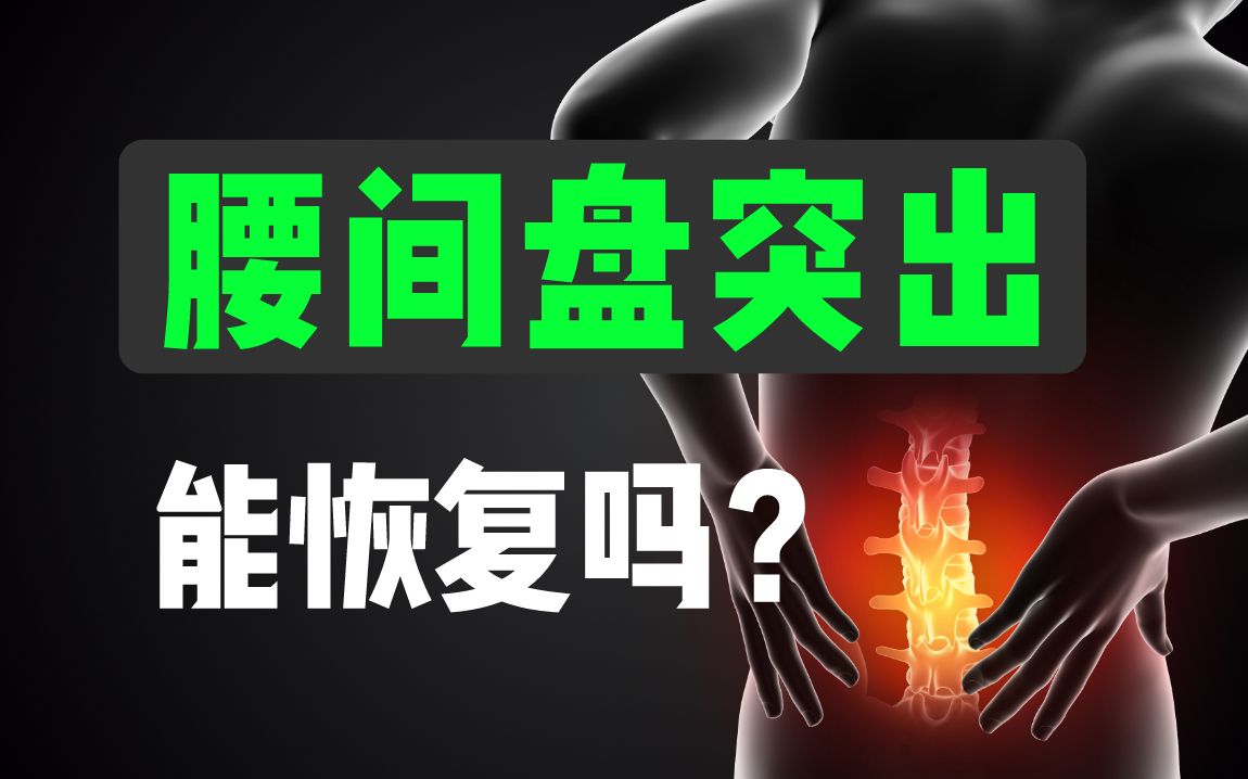 腰间盘突出能恢复吗?2大治疗误区一定要知道!哔哩哔哩bilibili