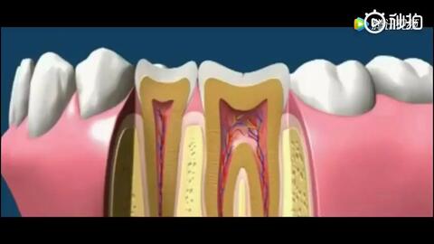 大连齿医生口腔 根管治疗虫牙不上心 牙齿小洞变大洞怎么办 根管治疗拯救被蛀牙被掏空的牙齿 哔哩哔哩