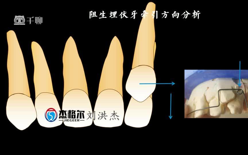 [图]杰格尔正畸196课时 口腔正畸课程