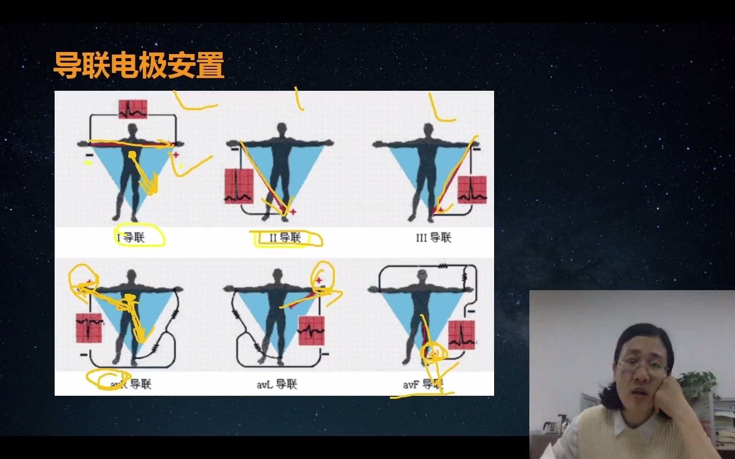 2022年护理考研专业课护理综合308内科学循环系统心律失常心电图导联详解哔哩哔哩bilibili