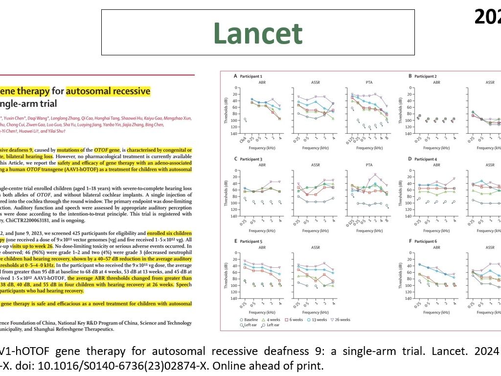 Lancet—基因治疗重磅:复旦大学科学家成功使用基因治疗技术治疗先天性耳聋,有望成为标准治疗方案哔哩哔哩bilibili