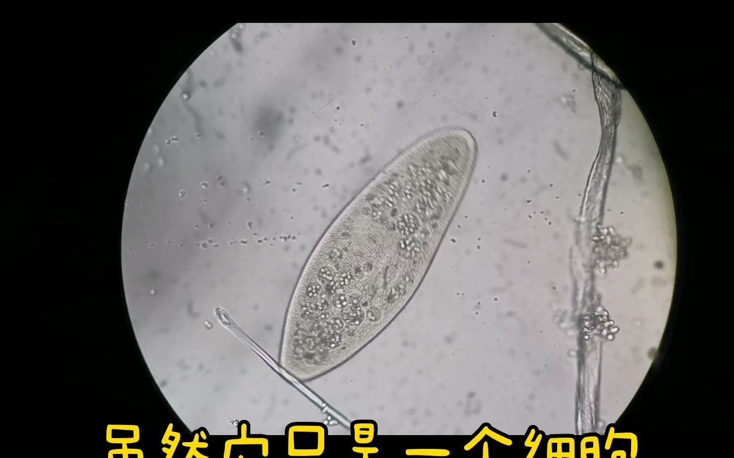 草履虫显微镜下的图片图片
