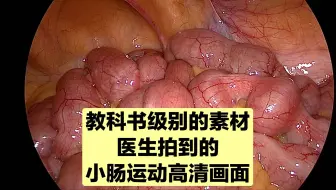 涨姿势，原来肠管是这样动的，像是在肚子里面开派对，嗨起来了！