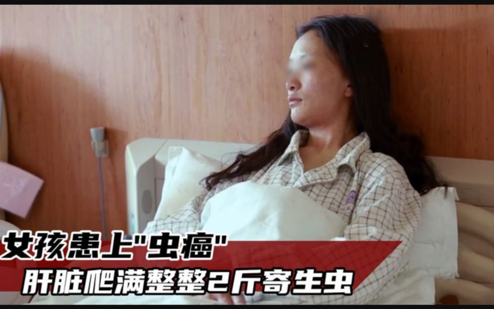 女孩身患"虫癌,医生打开肚子一看,肝脏爬满整整两斤虫子