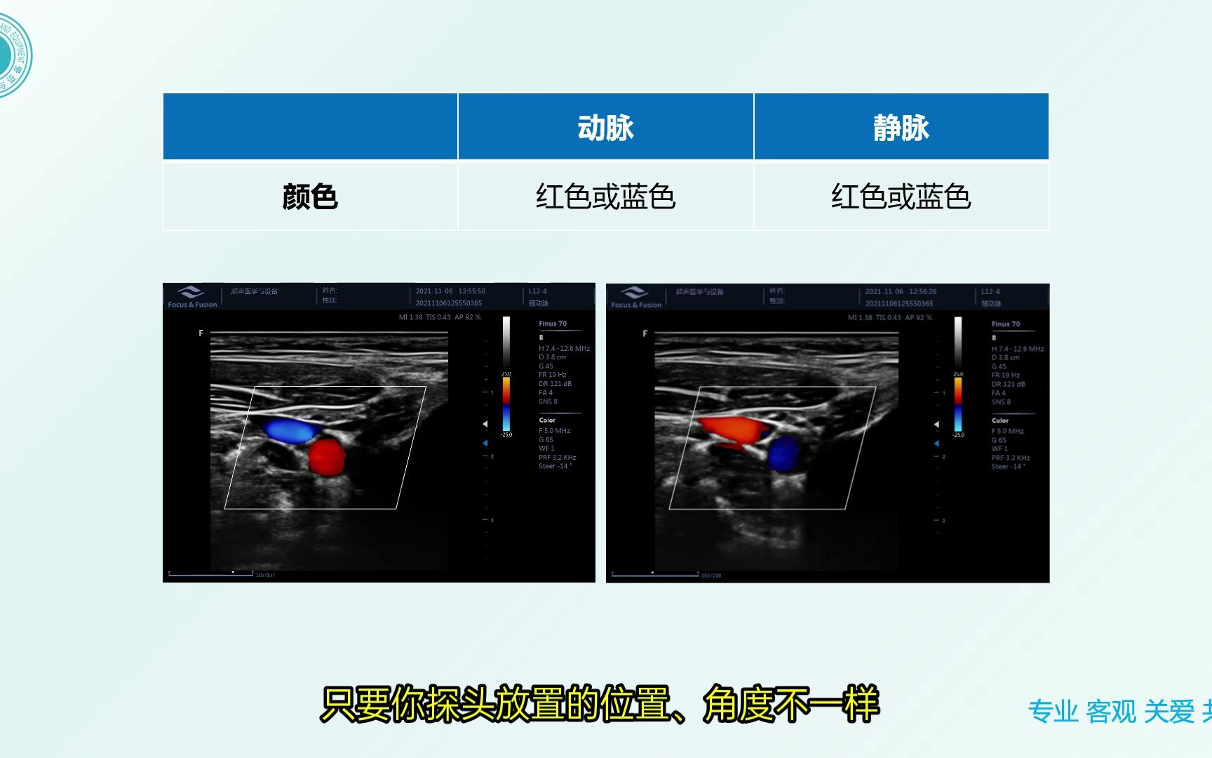 【漫谈超声】 那个高老师教你如何超声辨别动静脉.哔哩哔哩bilibili