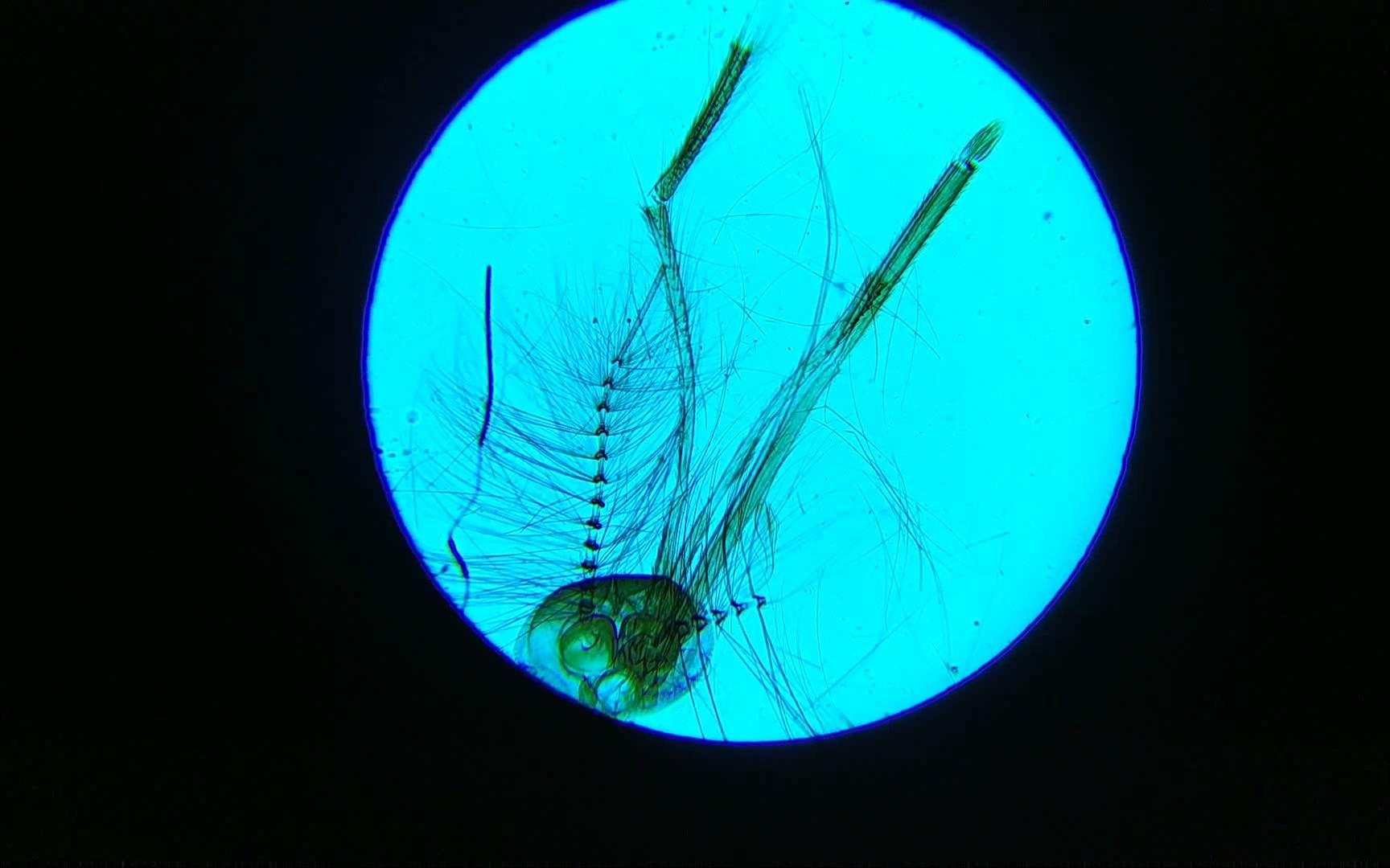 显微镜下给大家看看夏天蚊子就是用这个玩意吸我们的血的