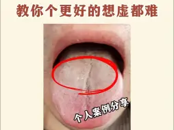 Download Video: 这种裂纹舌，手里的补肾药赶快扔掉！教你一个更好的，想虚都难