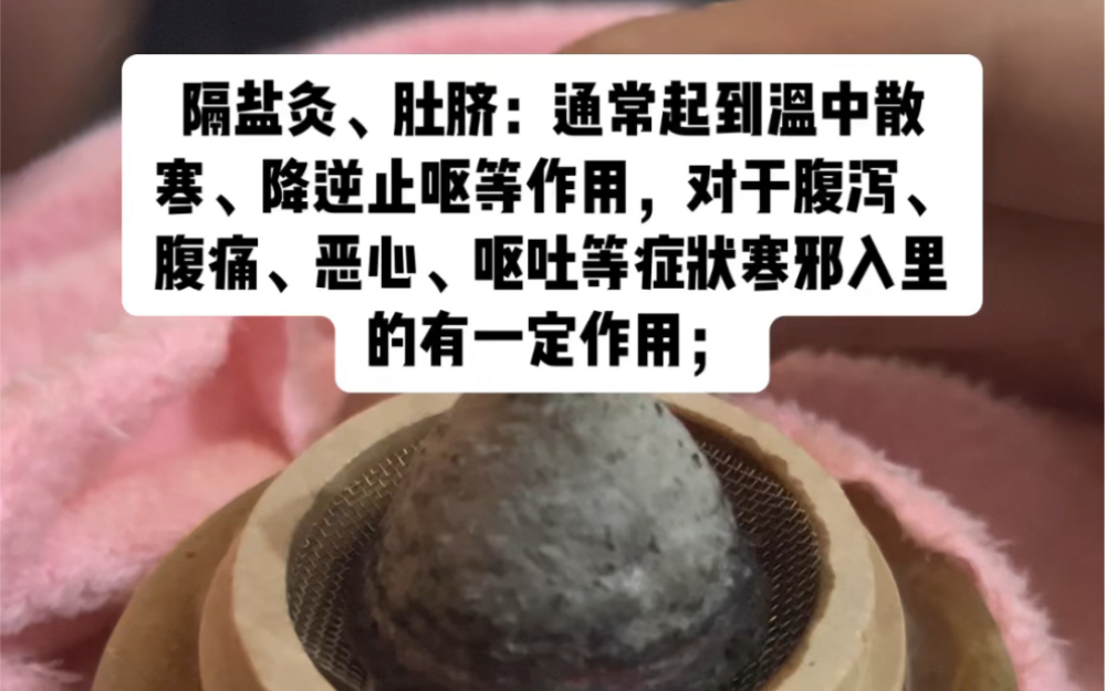 隔盐灸神阙穴,昨天拉肚子灸下就好了