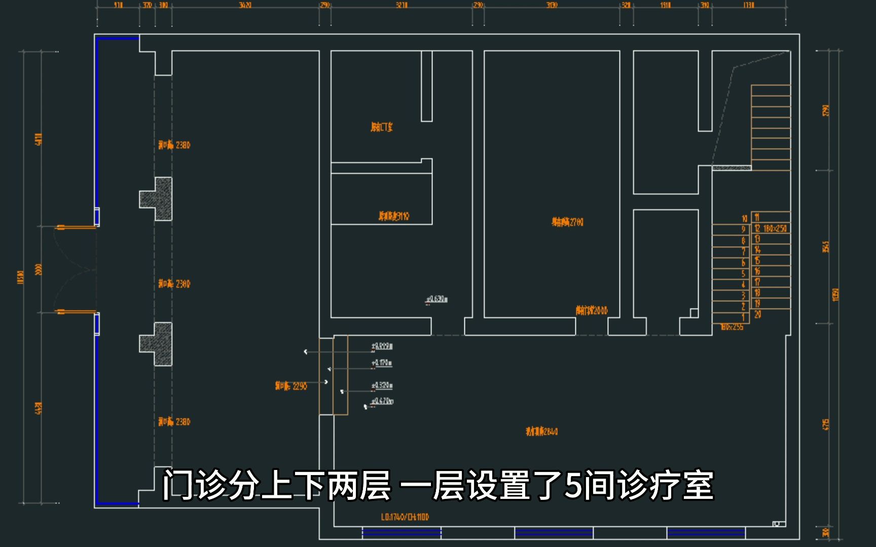 300平口腔诊所装修设计郑州口腔诊所装修设计新密李静口腔设计效果图哔哩哔哩bilibili