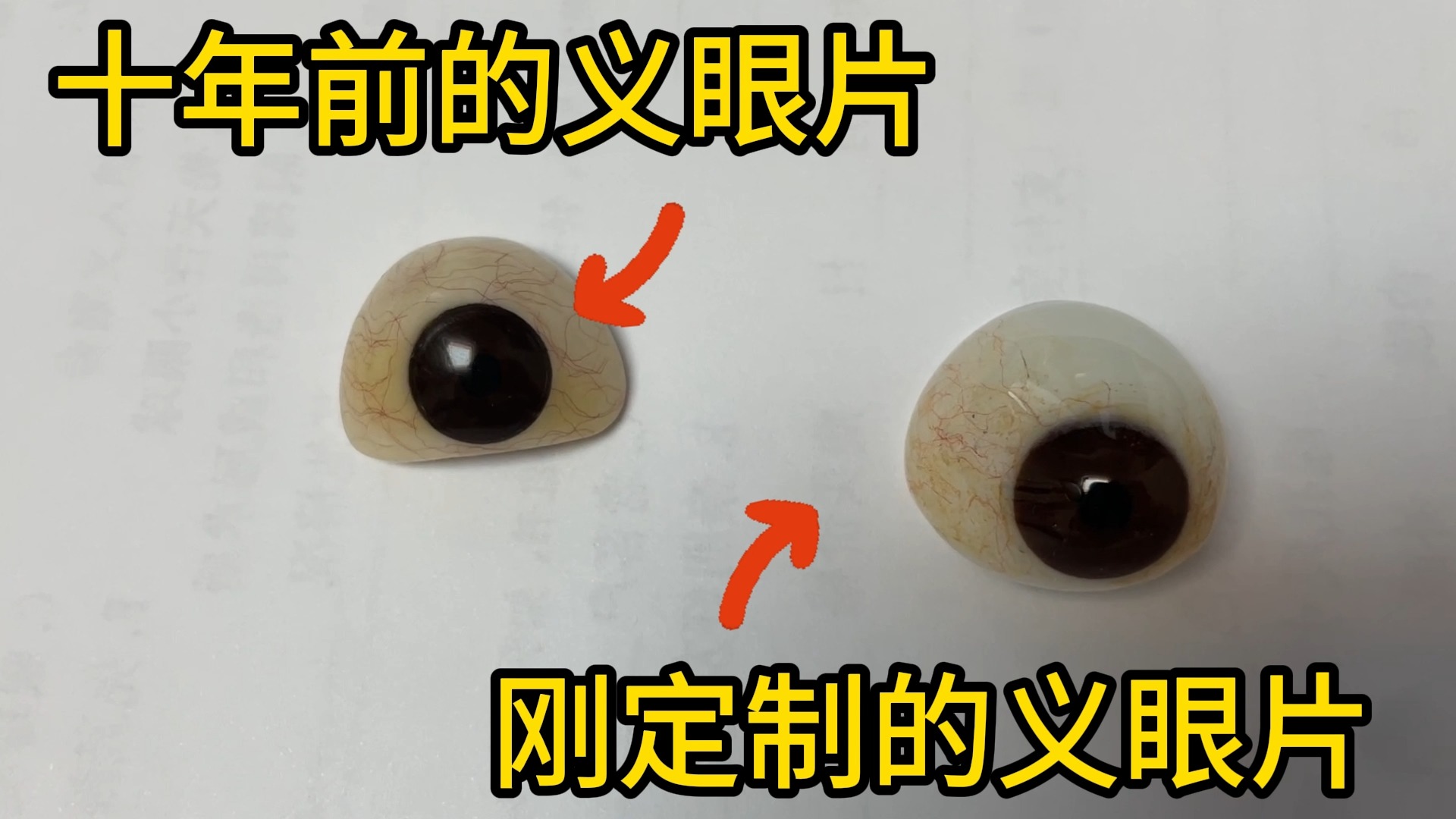十年前做的义眼片和现在定制的义眼片,你们觉得哪个更逼真呢?