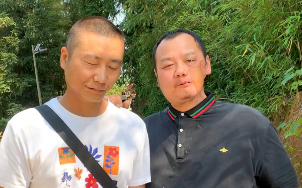 同样的案例同样的经历,希望屏幕前的你们引以为戒远离槟榔#口腔癌与