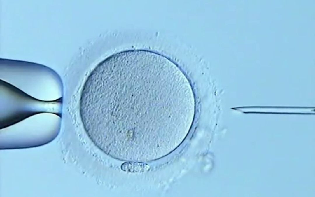 icsi卵胞浆内单精子显微注射技术