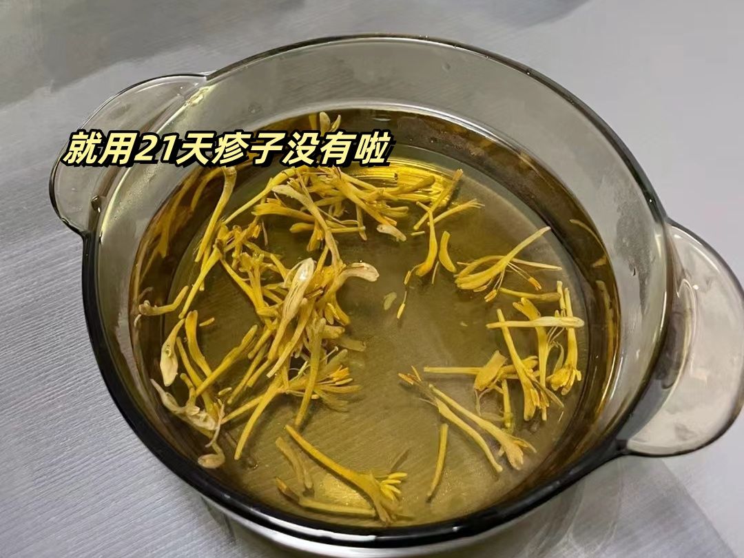 听人劝!背上起疹子的朋友试试用金银花加它,彻底摆脱湿疹烦恼!