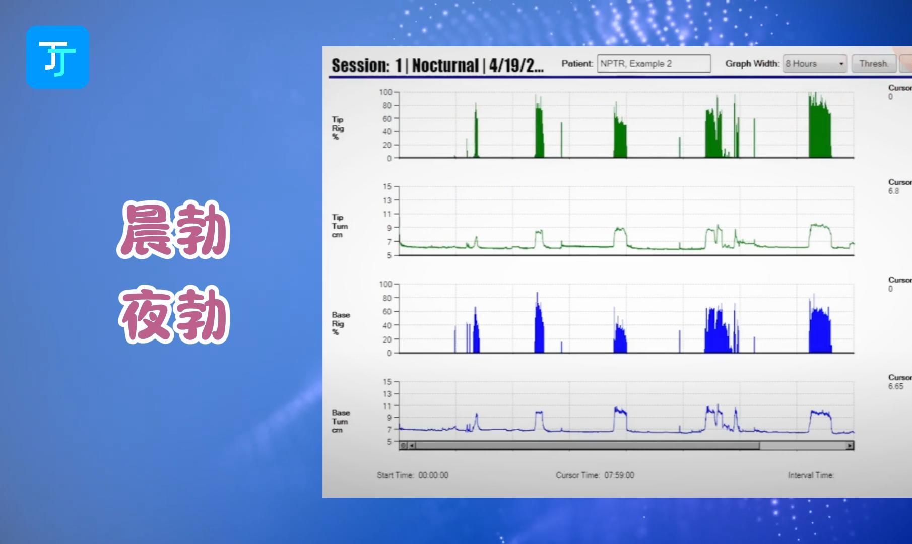 一张图,带你认识“夜勃”与“晨勃”哔哩哔哩bilibili