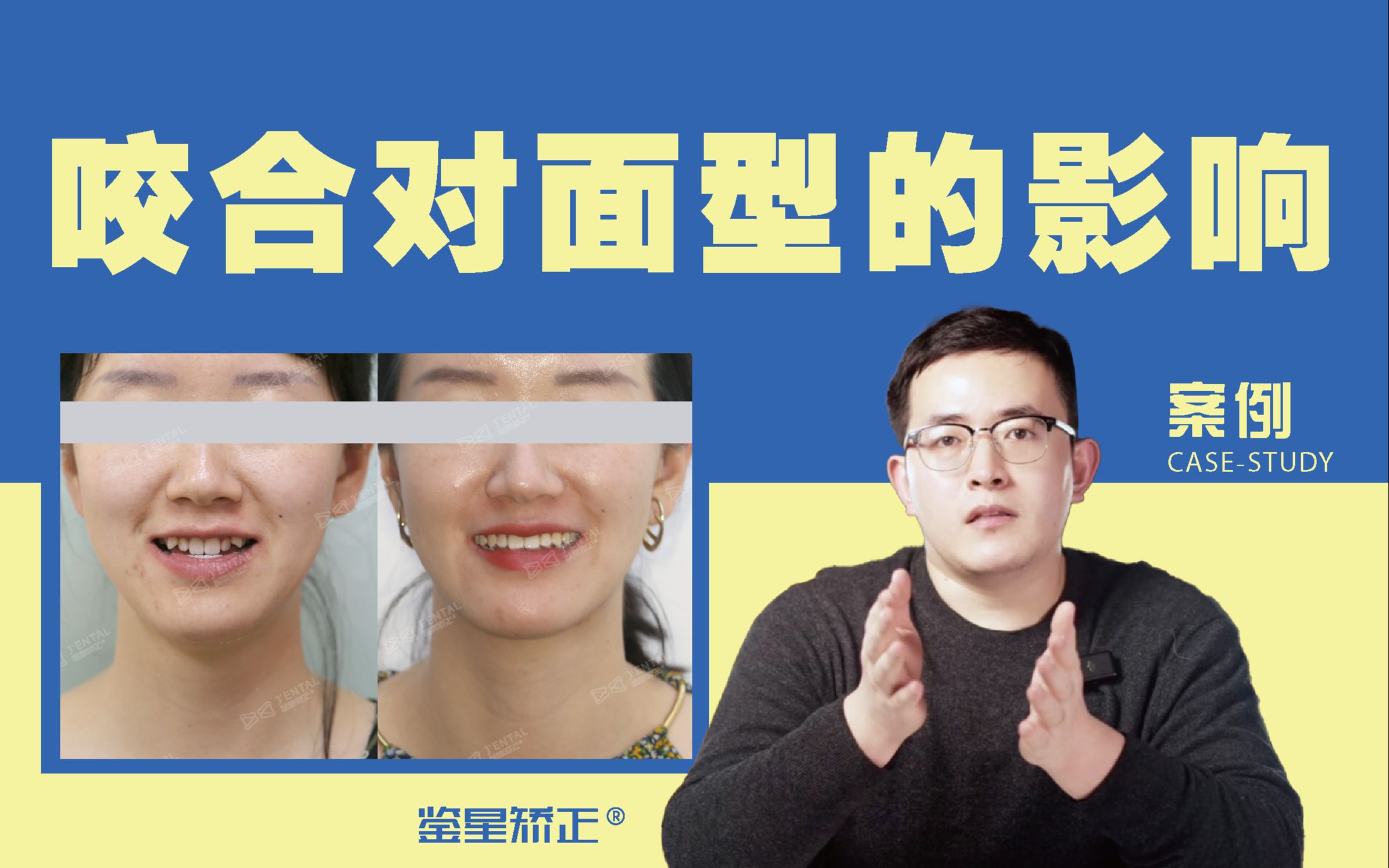 咬合不对,会导致脸型越来越难看?