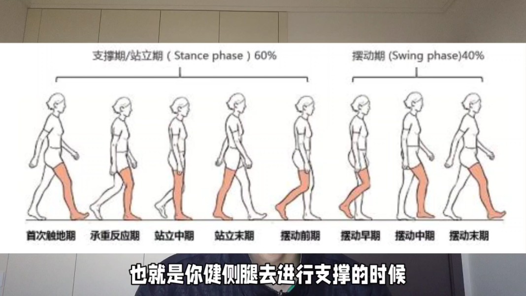 偏瘫后的画圈步态:症状、原因与解决方法哔哩哔哩bilibili