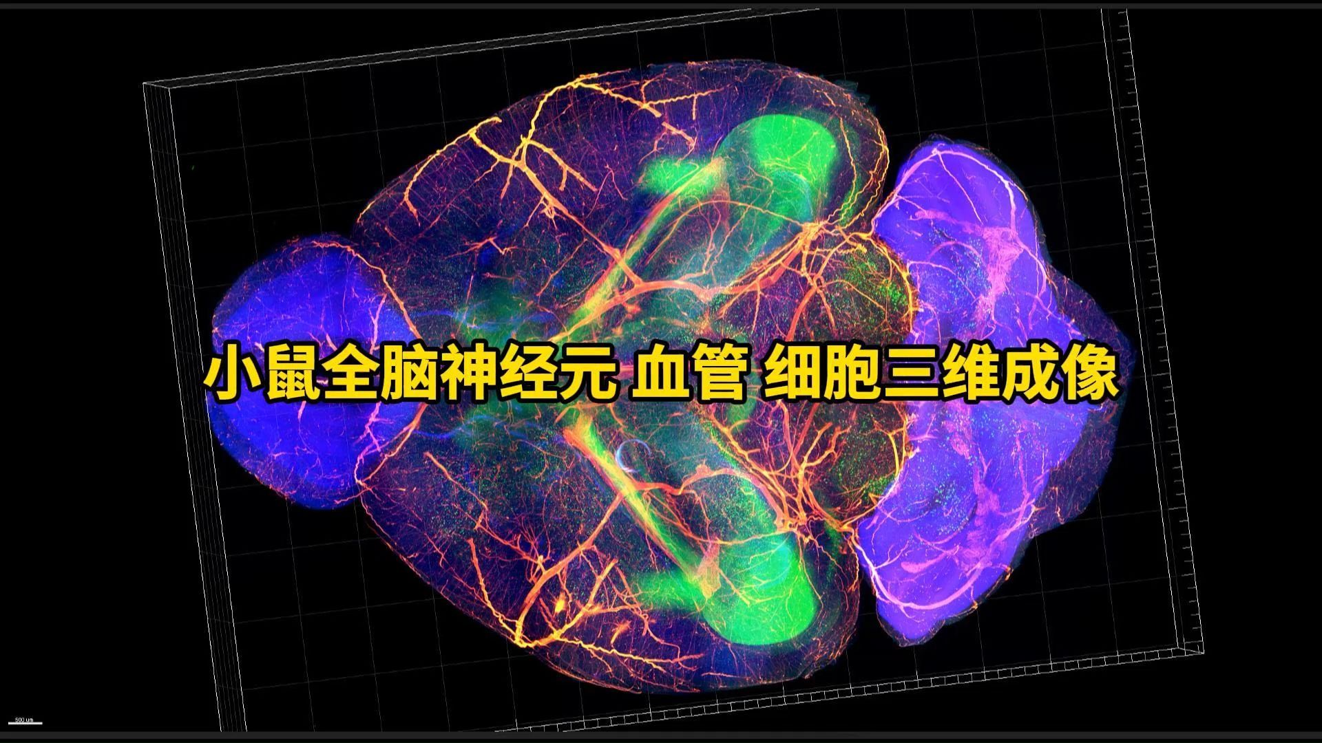 小鼠全脑透明化,神经元,血管,细胞三维整体成像!