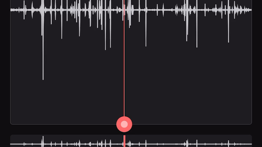 肠鸣音右下及左下腹部低频流水音及鼓音12分钟(气过水音)哔哩哔哩bilibili