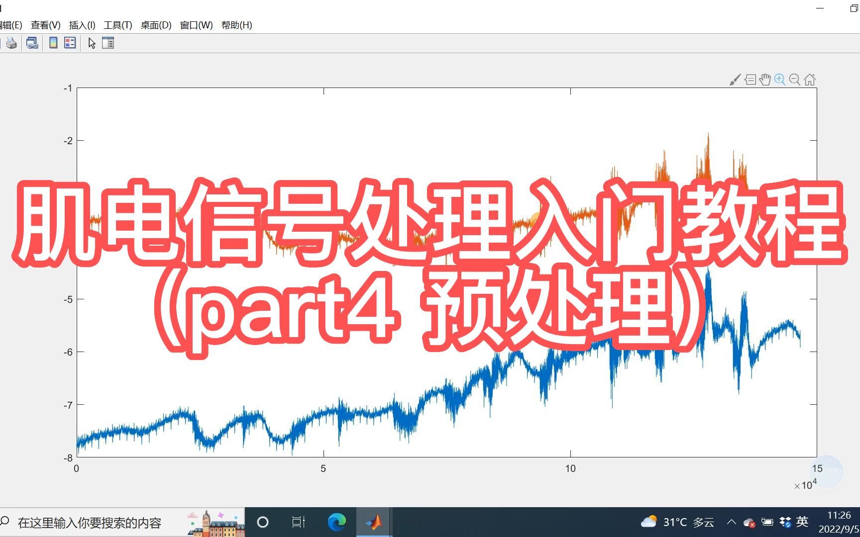 NO.36 肌电信号处理入门教程(part4 肌电信号预处理)哔哩哔哩bilibili