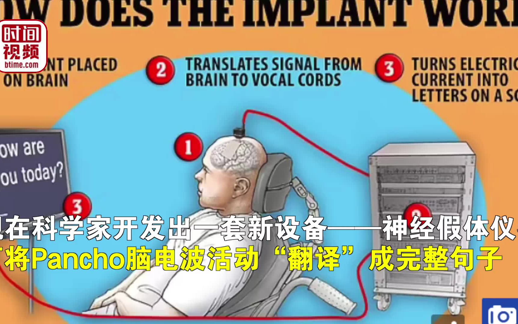 直抒胸臆!美国瘫痪者使用脑波仪器“说话”:我讨厌医院的饭哔哩哔哩bilibili