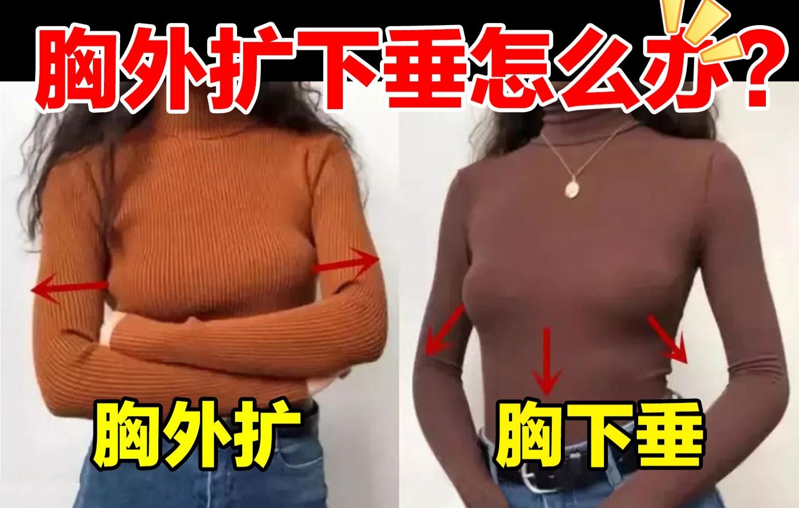 隆胸医生才杰|【干货】胸下垂/外扩/副乳怎么办?是怎么造成的?哔哩哔哩bilibili