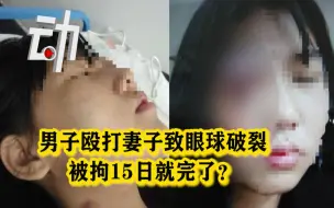 下载视频: 【还原】男子殴打妻子致眼球破裂被拘15日续： 当地妇联称已转为刑事案件