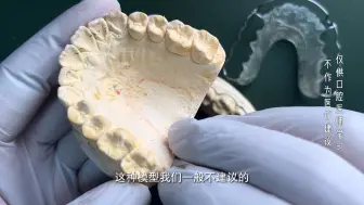 下载视频: 比格保持器 妃她正畸 儿童牙齿矫治器