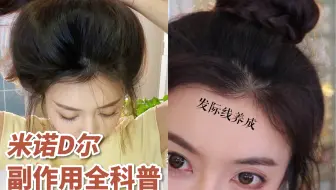爆发真不难！米诺地尔副作用，用前你一定要知道