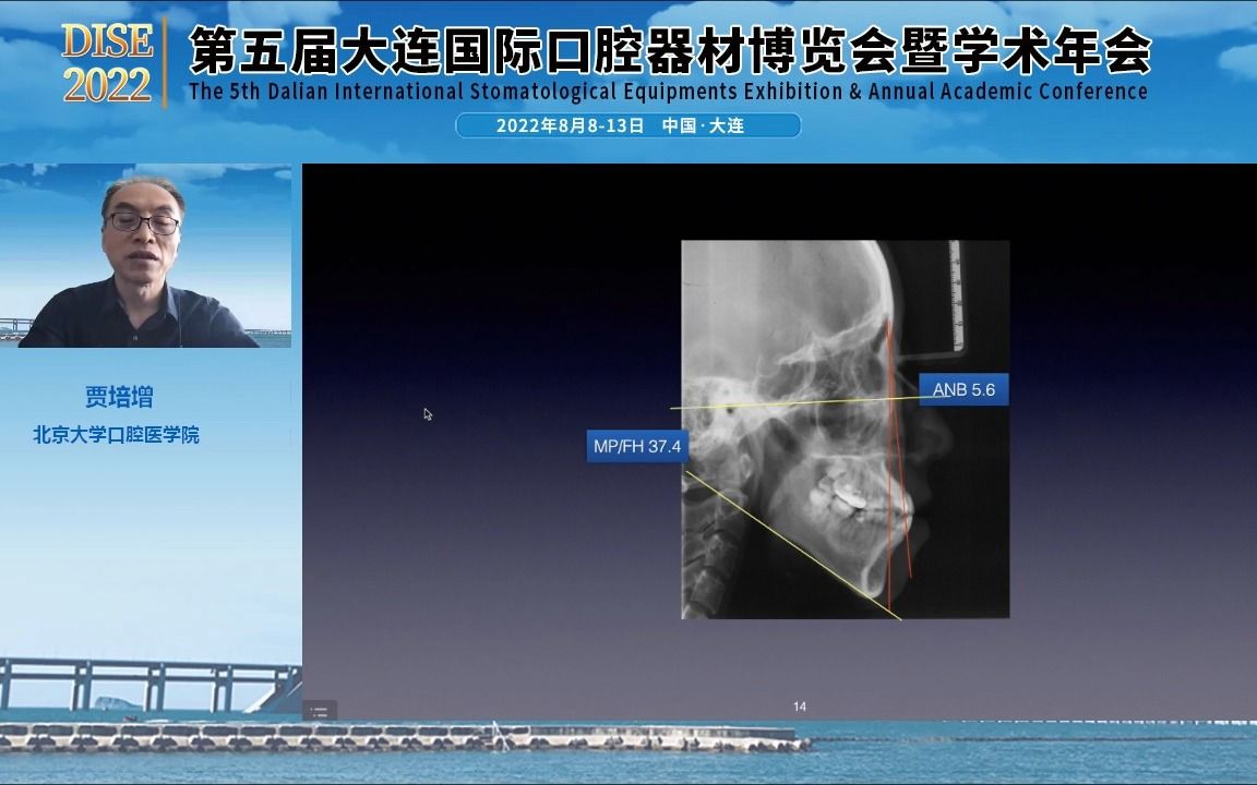 DISE2022 第五届大连国际口腔器材博览会暨学术年会——贾培增讲课哔哩哔哩bilibili