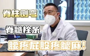 Download Video: 24岁男子脊柱侧弯还伴有先天性脊髓栓系，医生表示要尽快手术了