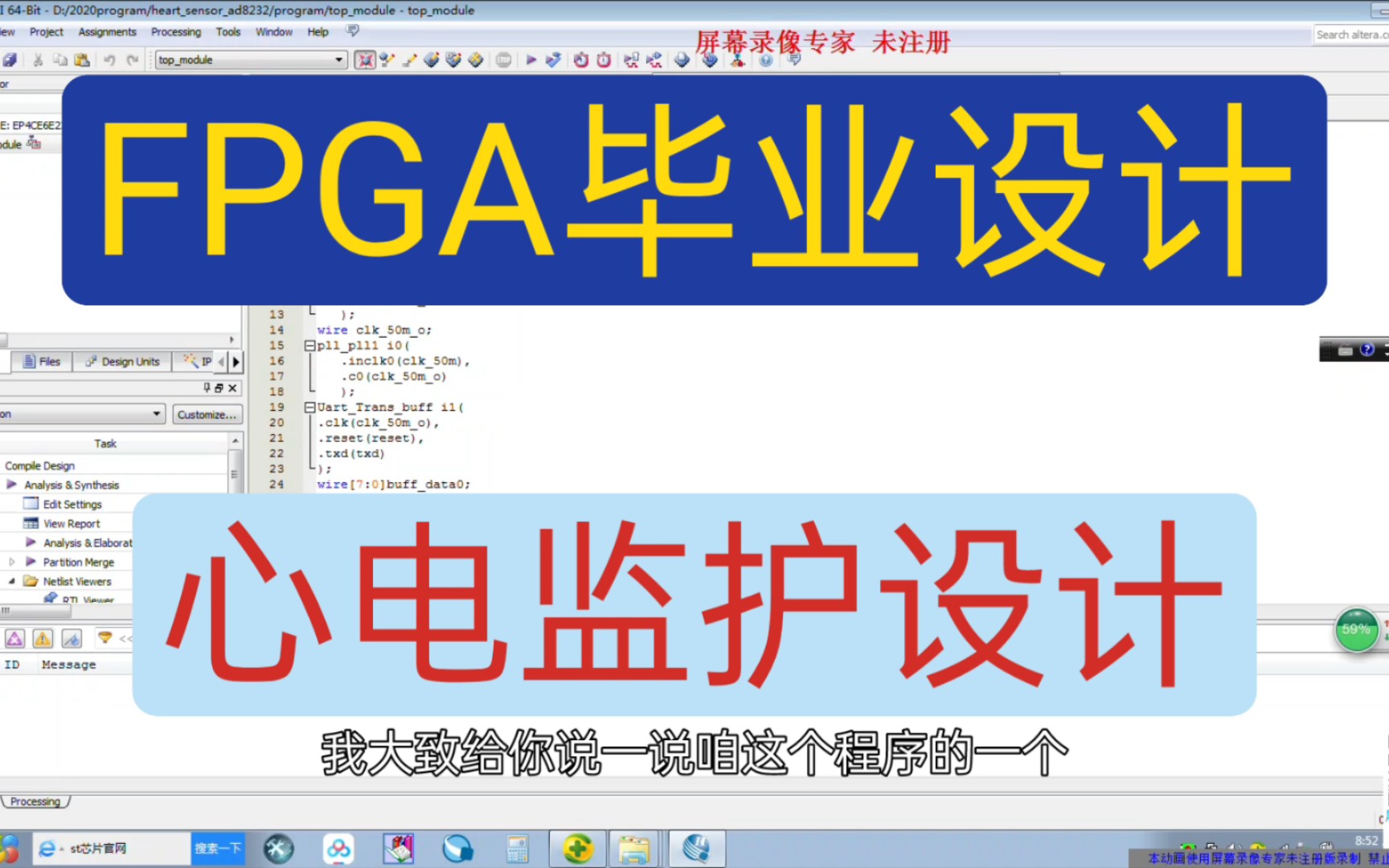 【心电监护】基于FPGA的心电监护设计,FPGA毕业设计哔哩哔哩bilibili
