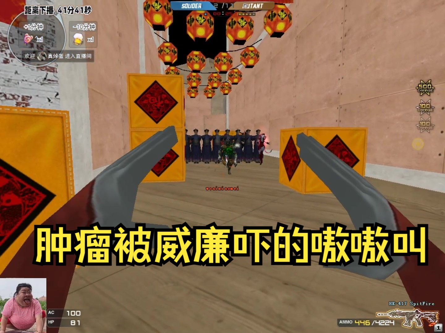 cf搞笑:肿瘤被威廉吓的嗷嗷叫