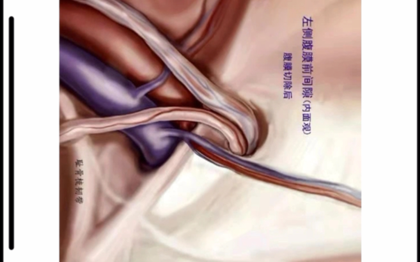 腹股沟区解剖-6.髂耻束2