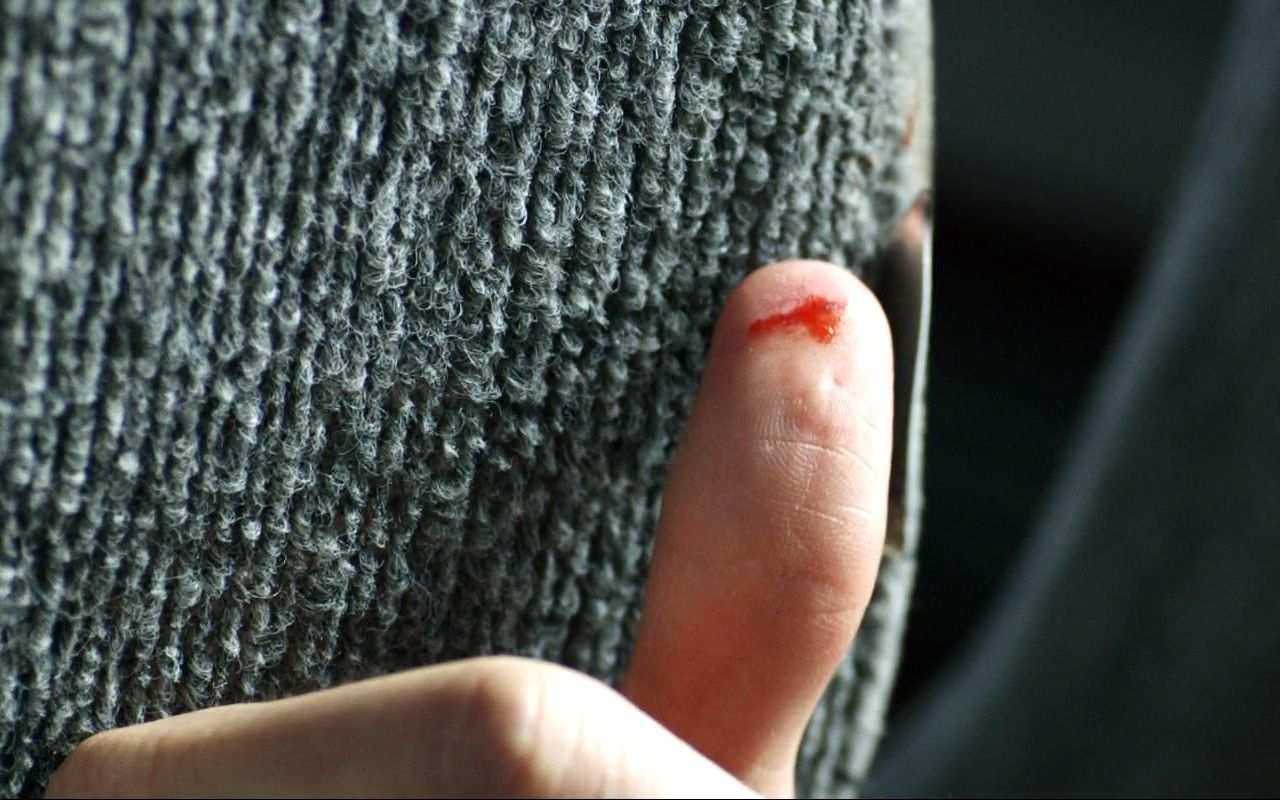 小伙坐车手指被扎破出血,立马感觉不对劲,大喊所有人下车