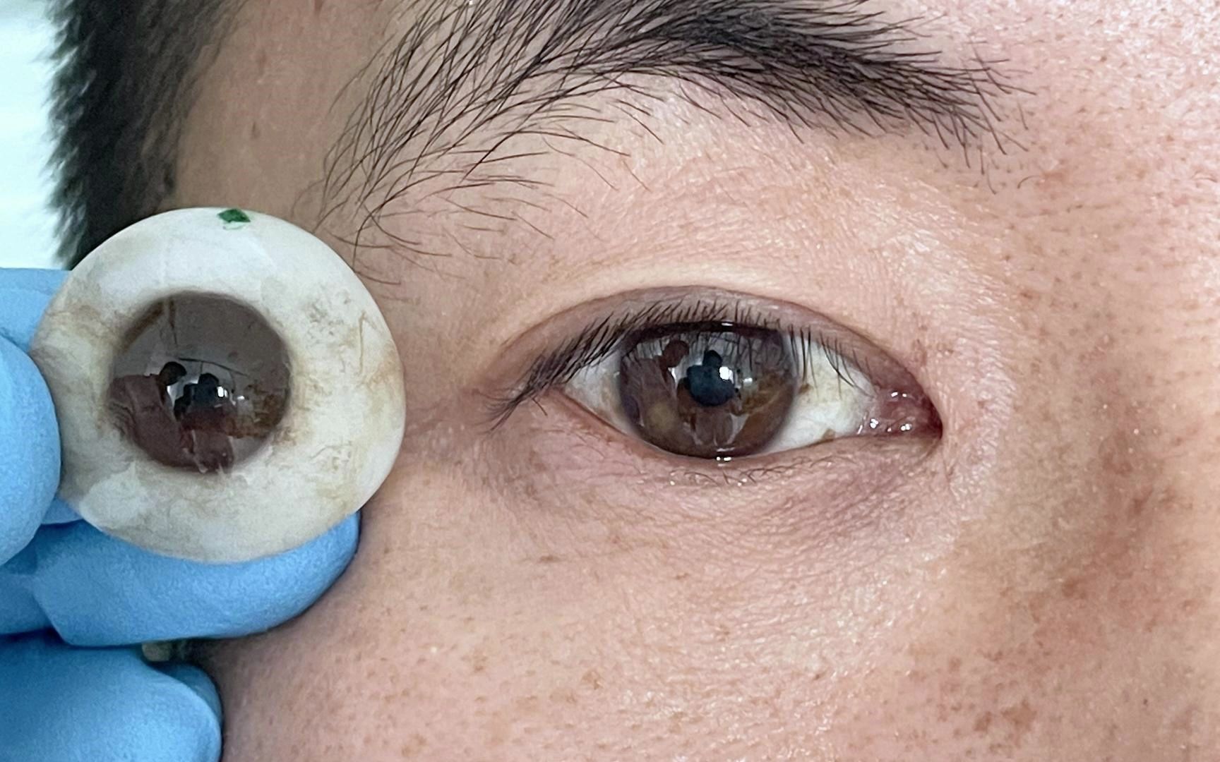 为山西临汾老乡定制超薄义眼片98好真实