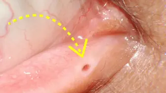 你真的了解你的身体吗？那么这是什么？你所不知道的奥秘，涨知识