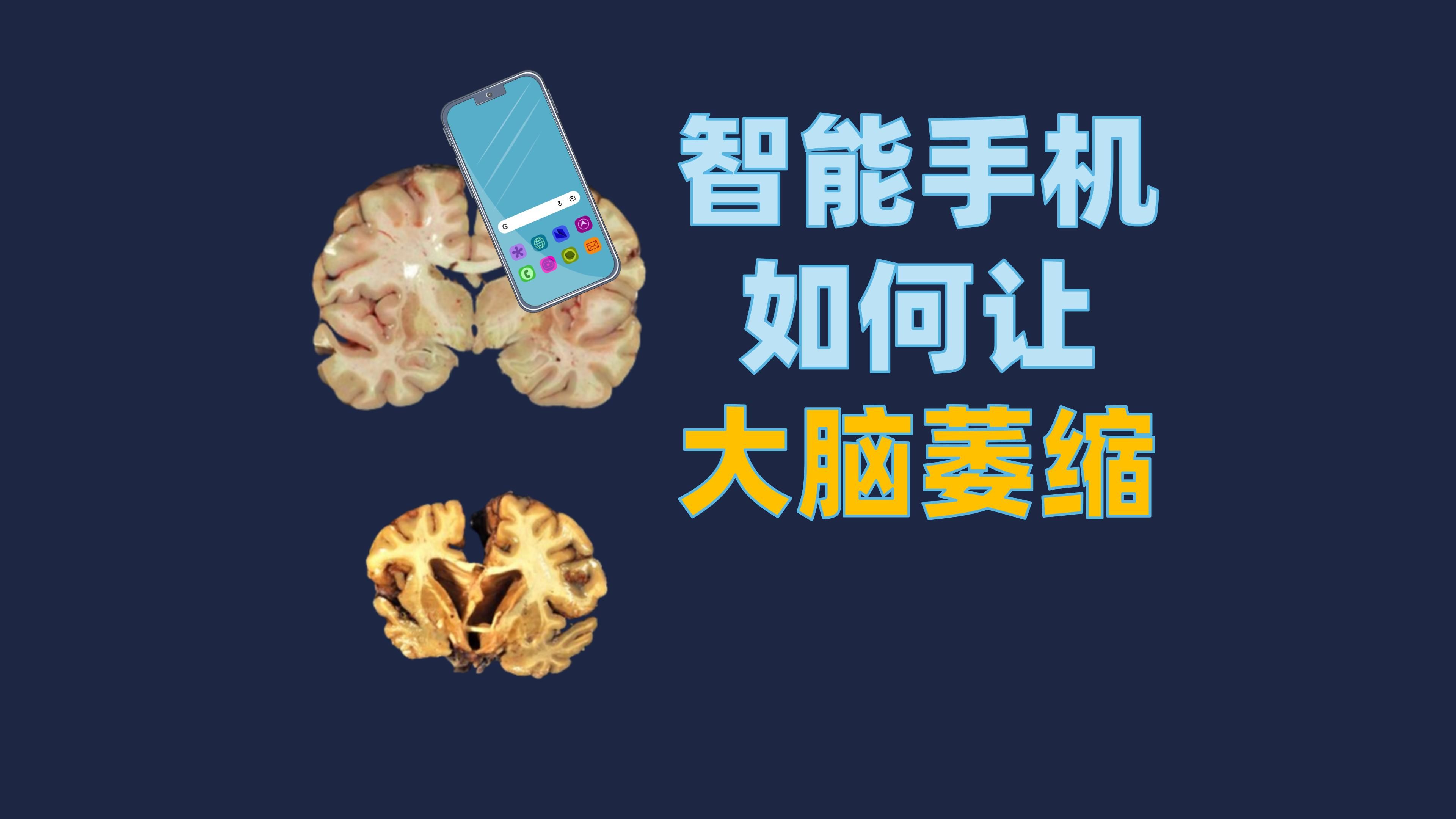 智能手机如何让大脑萎缩